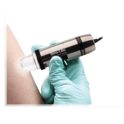 Video Dermatoscop USB pentru dermatoscopie computerizata Marire pana la 200X Video Dermatoscop USB pentru dermatoscopie computerizata Marire pana la 200X